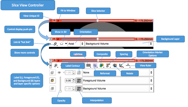 Slice View Controller of 3D Slicer