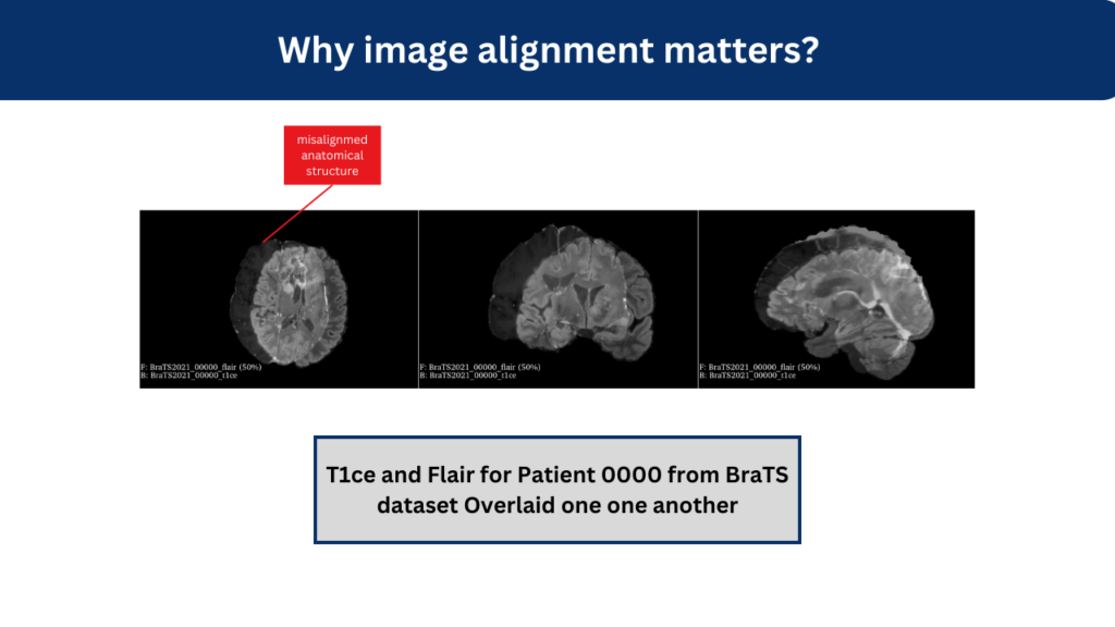 why image mislaignment matters