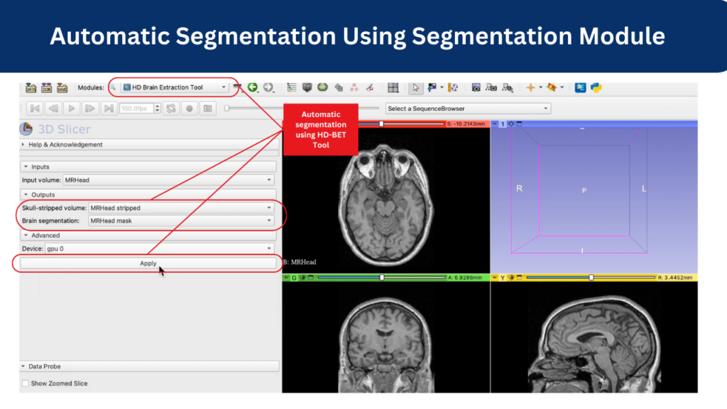 Automatic Segmentation Using Segmentation Module