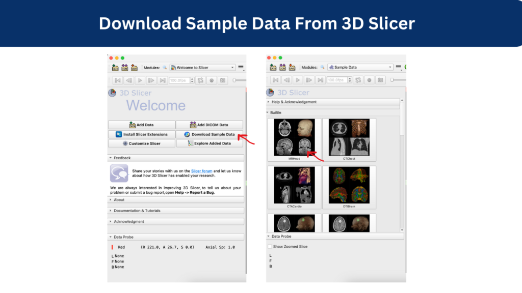 Download Sample Data From 3D Slicer