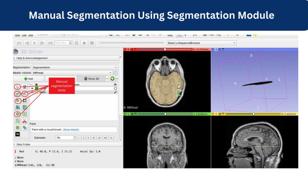 Manual Segmentation Using Segmentation Module