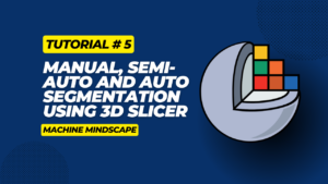 Manual, semi-auto and auto segmentation using 3d Slicer