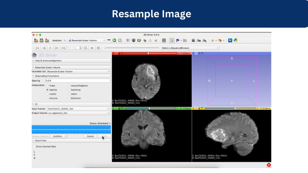 Resample Image to ensure consistent spatial orientation, resolution and voxel size