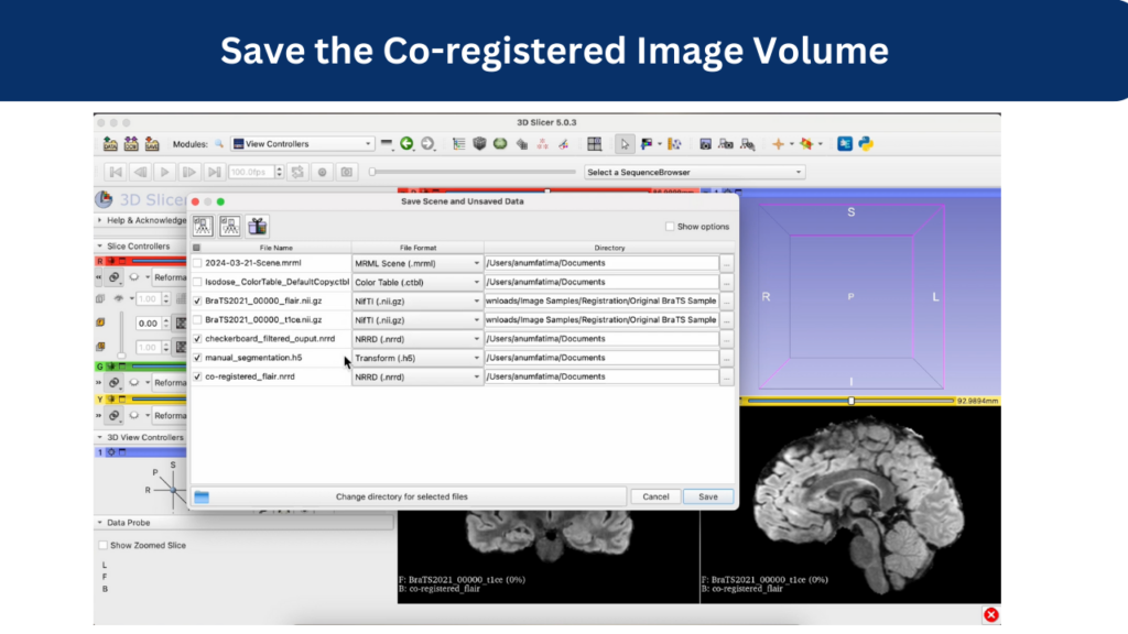 Save the Co-registered Image Volume